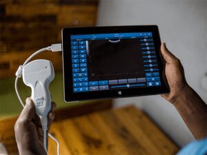 Medics in Uganda innovate portable ultrasound device Medics in Uganda innovate portable ultrasound device